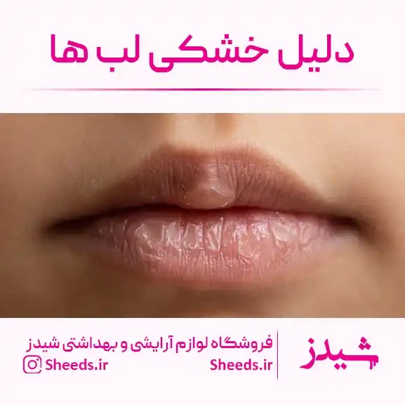 دلیل خشکی لب ها
